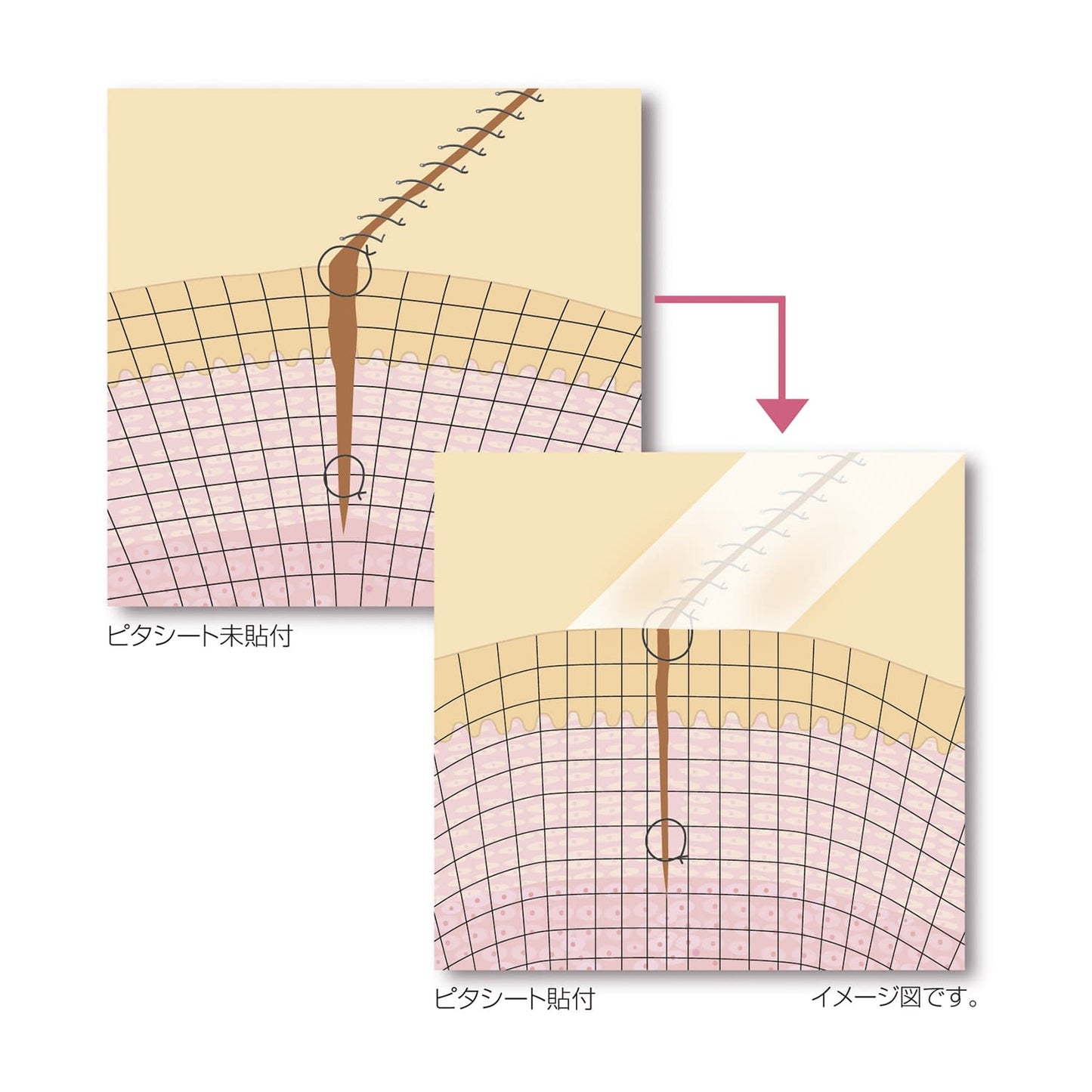 Pitasheet (Hard) Hard Dressing Material 23-7434-01 Alcare 19011 (3-pack)