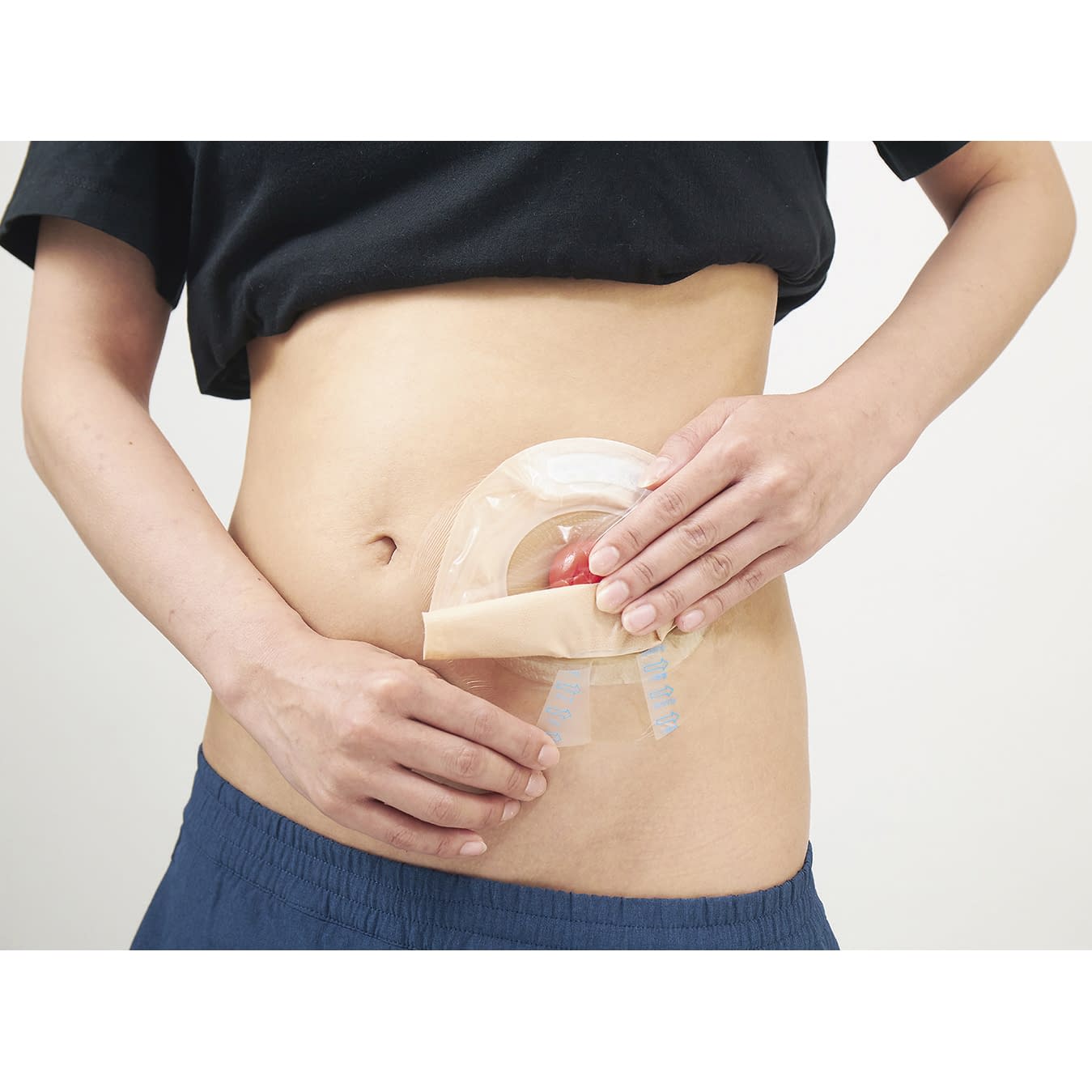 카테리 플러스 커브 드레싱재 25-2886-00 니티반 CPSC0412(30마이)