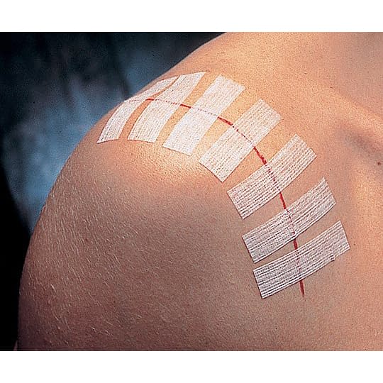 스테리스 스트립 스탠다드 피부 접합용 테이프 24-9498-00 쓰리엠 재팬 R1540(3X75)