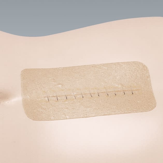 Karaya Hessive Clear (C-6) C-6 Dressing Material 23-6332-02 Alcare 15182 (10 pieces) 15X5CM