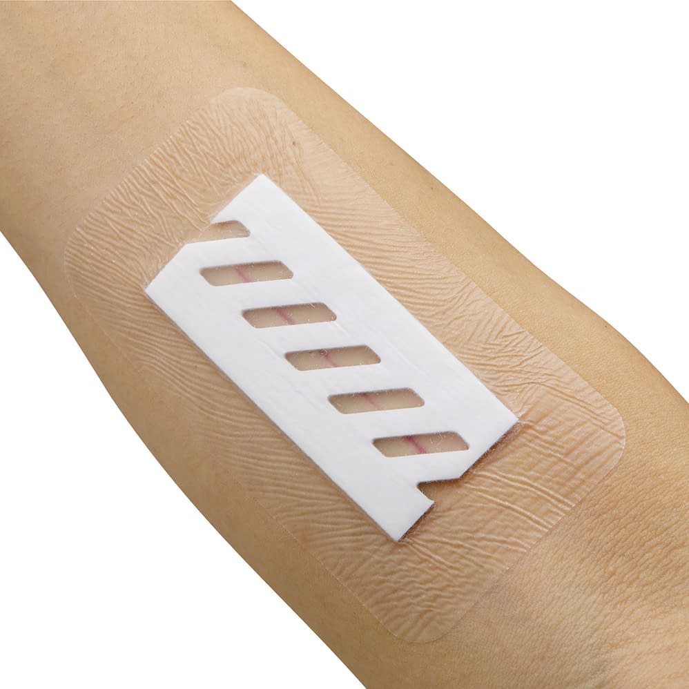 서지 피트 드레싱재 24-7921-01 니티반 SRG0915(20마이일리)