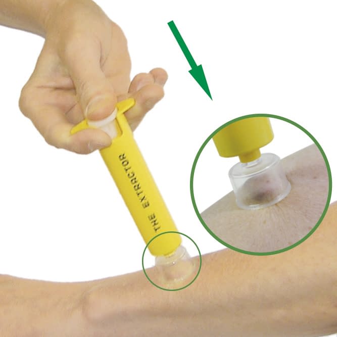 ポイズンリムーバー・エクストラ 毒吸引器 11-2636-00 飯塚カンパニー AP-011(1コイリ)