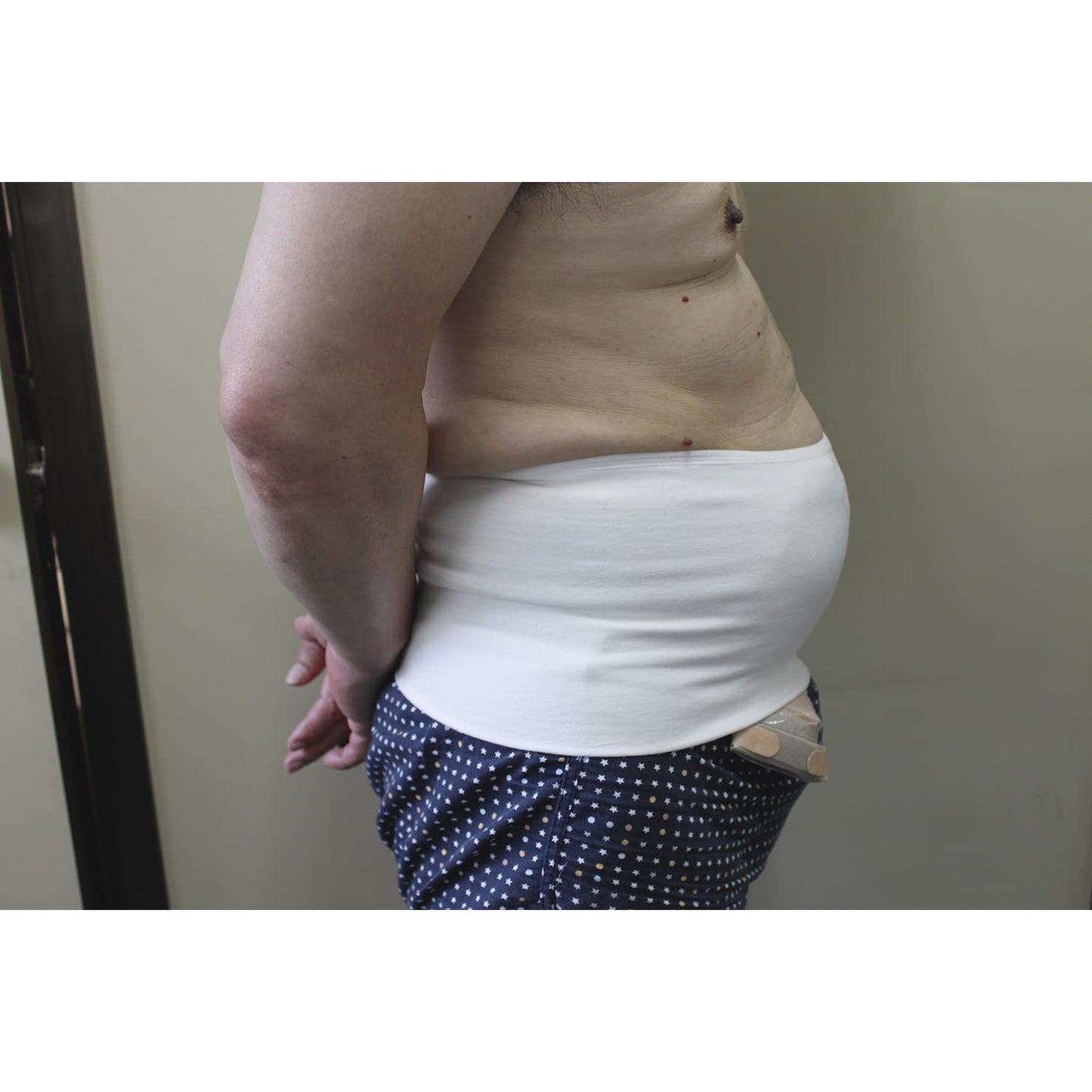 Hernia Abdominal Band Shimal Fine Hernia Band 24-2181-00 Mimuro 4030mm (M)