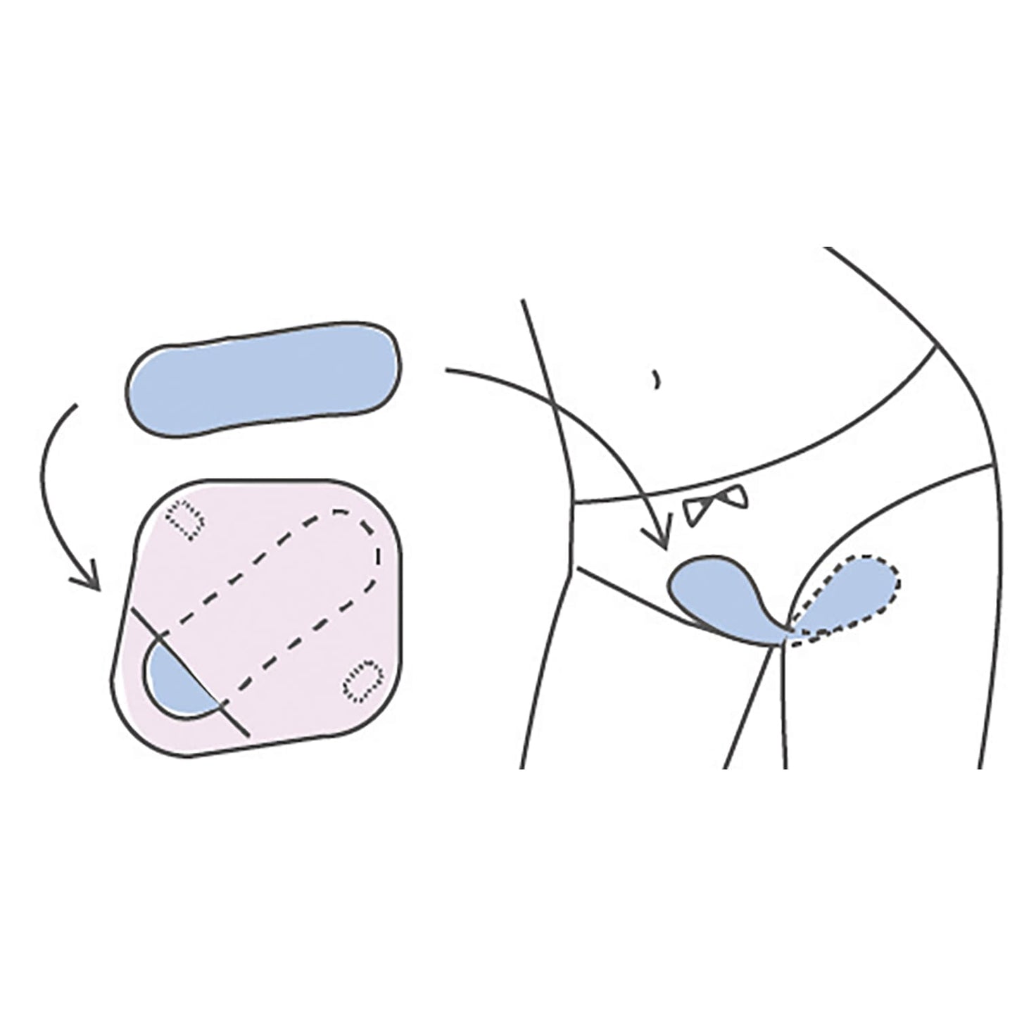 랄루 음부 용 핫 & 쿨 팩 온랭 팩 25-7278-00 미에 화학 공업 LUL-003 (퍼플)