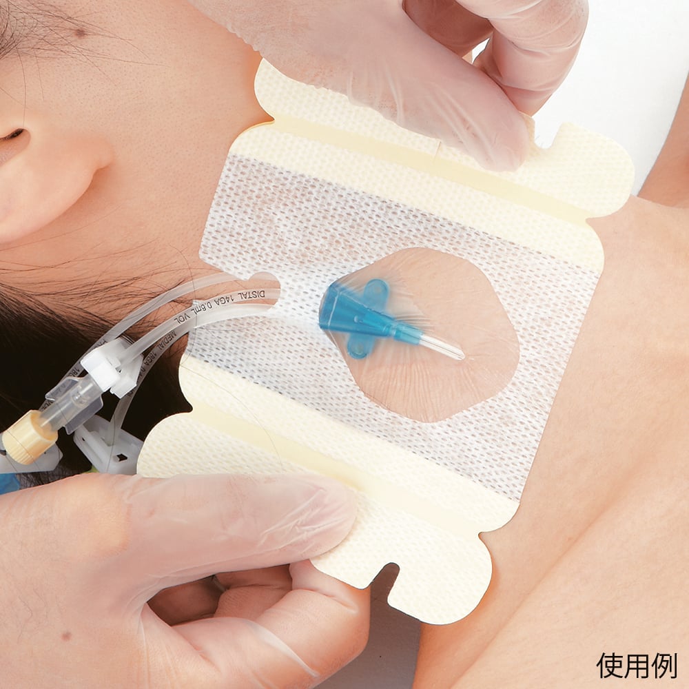 カテリープラス(TM) I.V. スリット入り (80×95mm) IVS0810(スリット入り) 1箱(30枚入)