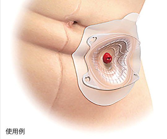 센슈라 미오 1 딥 단품계 장비·콜로스토미/일레오스토미용 25φmm 투명 1상자(10장입) 16771 1상자(10장입)