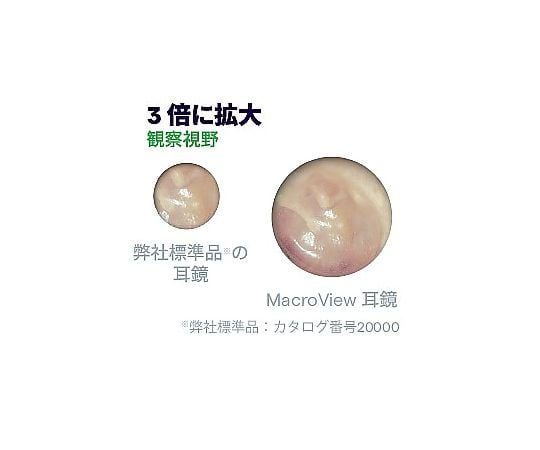 マクロビュー ベーシック 238-2 1個