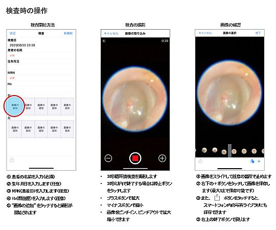 iExaminer キット 11840-IEX 1セット