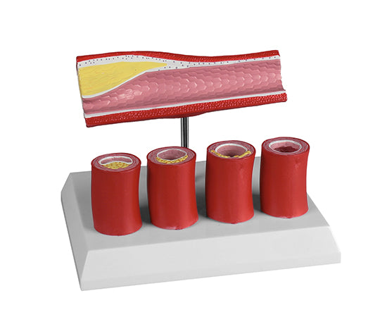 Arteriosclerosis model G240 1 piece