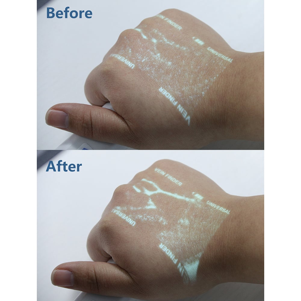 エンハンサー NVE100 1個