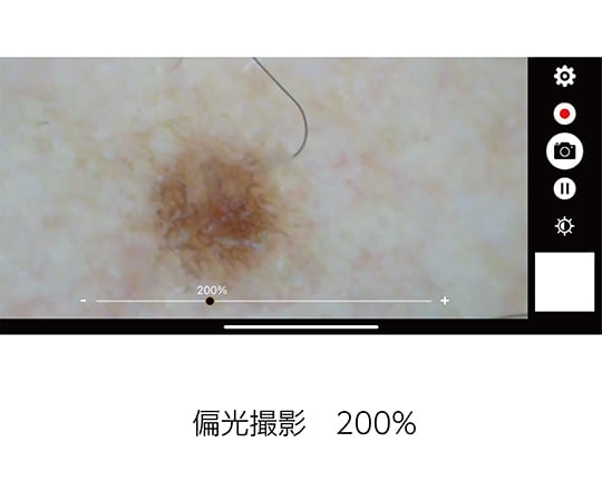 デジタルダーマトスコープ DE370 1台