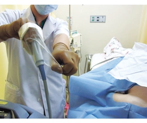 エコープローブカバーⅡ(人体開口部用・術中用) 2500mm 1箱(12セット入) P09250 1箱(12セット入)