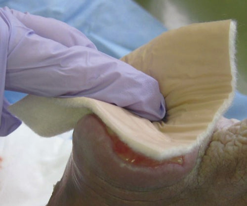 プラスモイストHSP ヘモスタパッド(出血創用タイプ) HSA7I 1シート