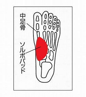 솔보타 테아치 서포터 슬림형(양발입) / 63296 S 1 페어