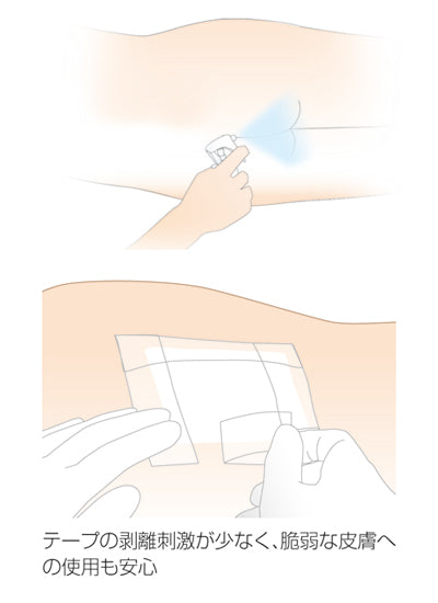 리모스 코트 / 17711 30mL 1개