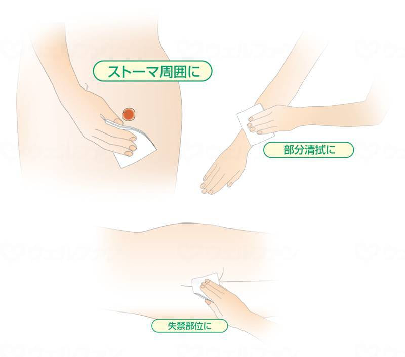 アルケアリモイス クレンズ(レギュラー・180g) レギュラー