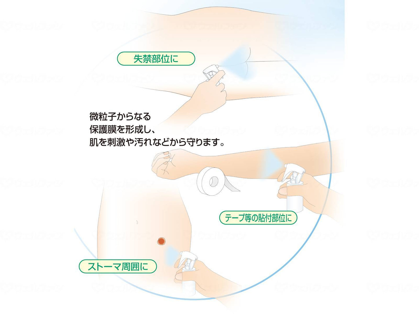 アルケアリモイスコート(30ml)