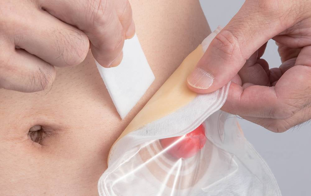 アルケアスムーズリムーバー/ワイプシート(20枚入り) 20枚入