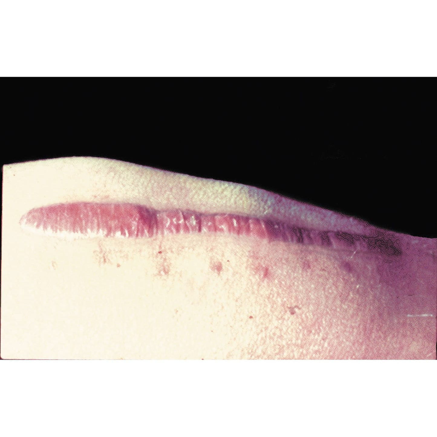 Mepiform Silicone Gel Sheet 22-2055-01 Mepiform 293200 (5X7.5) 5-piece set