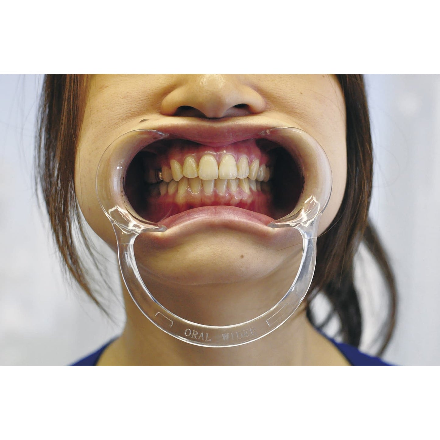 Oral Wider (Mini Soft Blue) Mini Soft Blue Mouth Opening Aid 23-2636-02 Zycor International Inc. OWMS