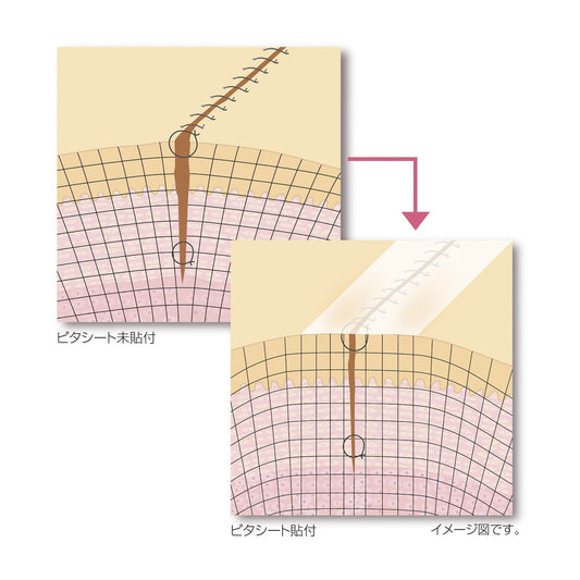 Pitasheet (Hard) Hard Dressing Material 23-7434-01 Alcare 19011 (3-pack)