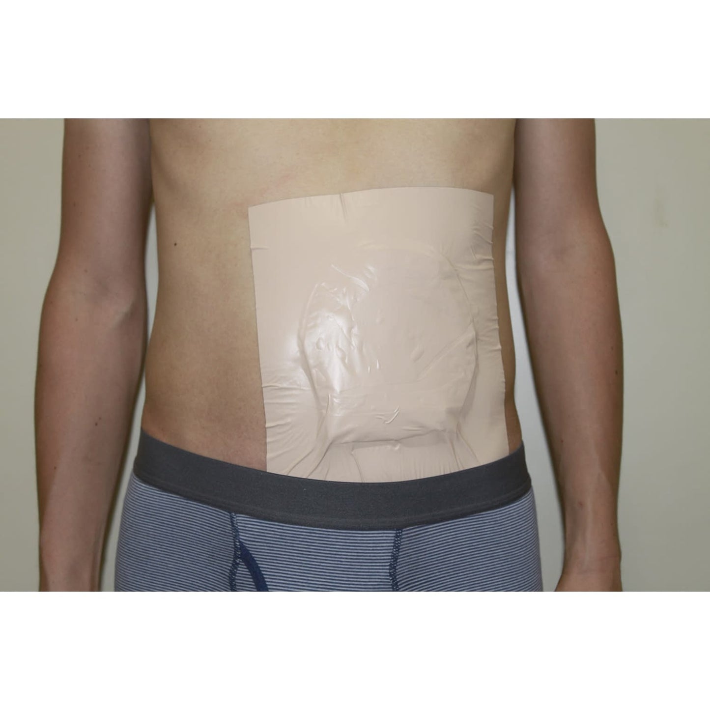 입욕용 파우치 보호 필름 스토마 케어 용품 24-6137-00 미무로 410(10 마이이리)