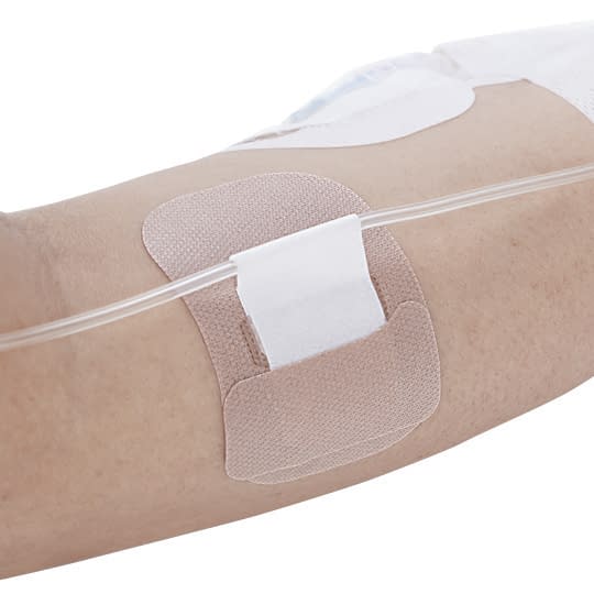 Quick Fix (No. 2) No. 2 Catheter Fixation Tape 24-3520-01 Alcare 19392 (100 pieces)