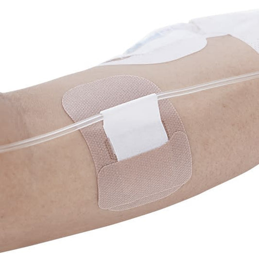 Quick Fix (No. 2) No. 2 Catheter Fixation Tape 24-3520-01 Alcare 19392 (100 pieces)