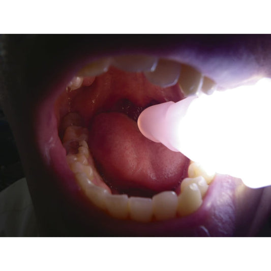 バイトロックII(やわらかめ) II・柔らかめ(オレンジ) 開口補助具 24-2996-00 デントケア DC-59(オレンジ)