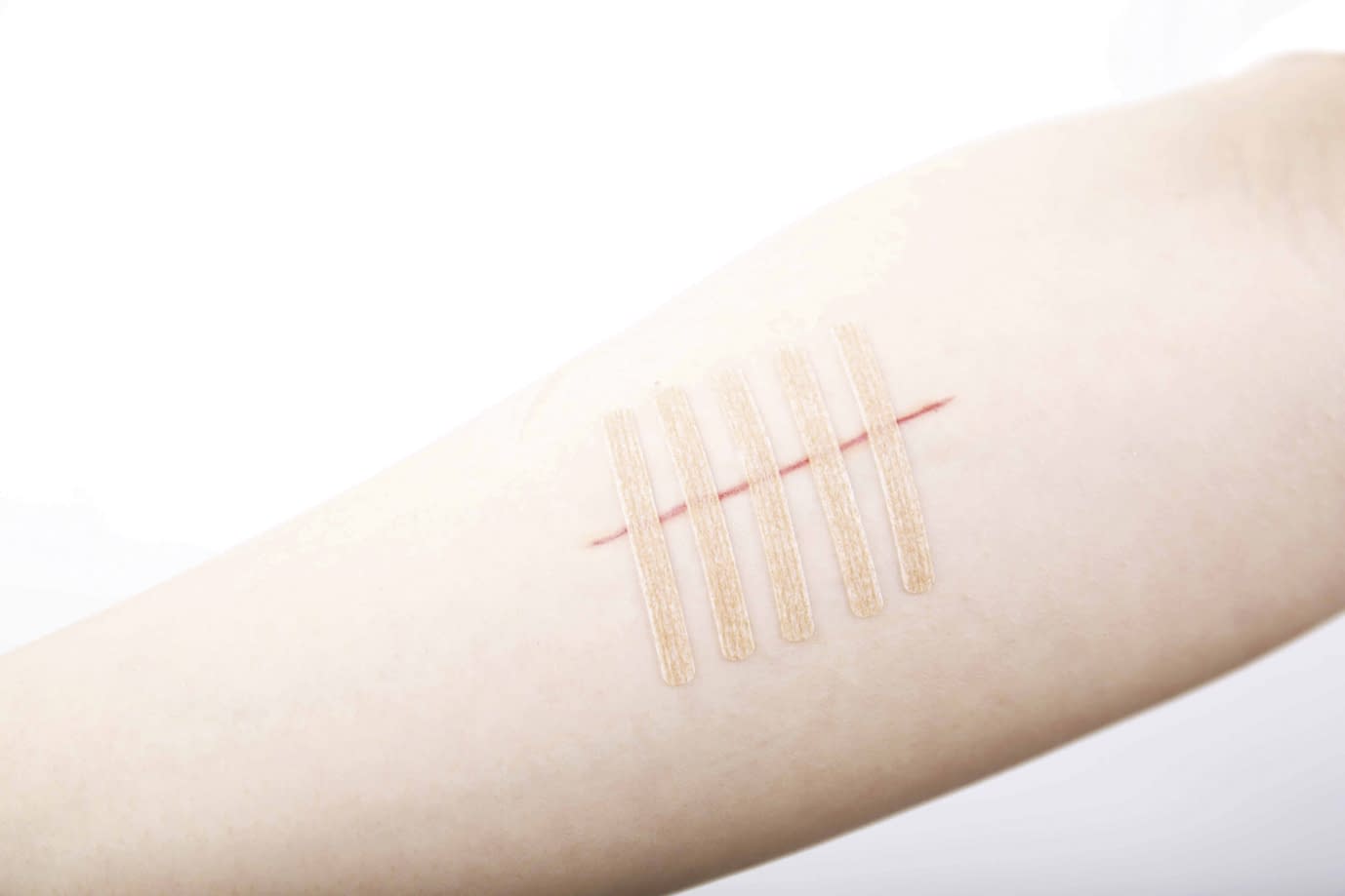 패스너트 No. 0676 피부 접합용 테이프 24-5411-04 니티반 FN0676(6X76)3 폰 X30