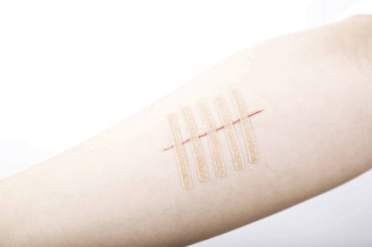 ファスナート No．1276 皮膚接合用テープ 24-5411-05 ニチバン FN1276(12X76)4ホンX30