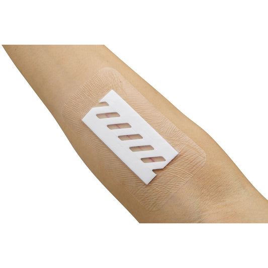 Surgefit Dressing Material 24-7921-03 Nichiban SRG0607 (50 pieces)