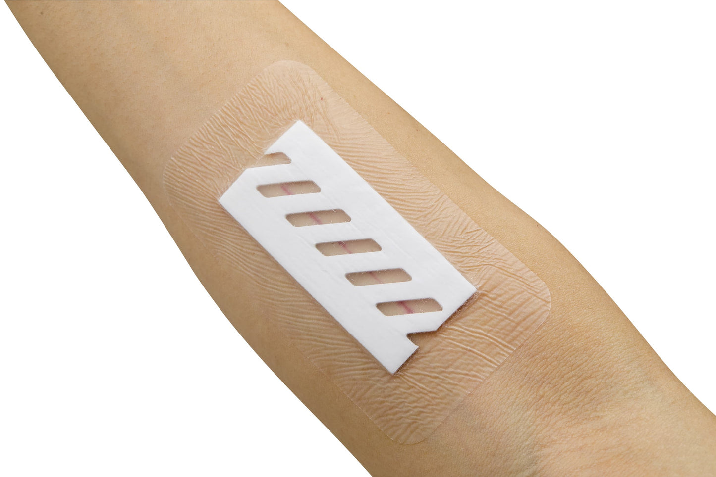 Surgefit Dressing Material 24-7921-04 Nichiban SRG0927 (10 pieces)