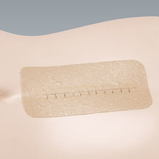 Karaya Hessive Clear (C-2) C-2 Dressing Material 23-6332-00 Alcare 15185 (30mm) 5X5CM