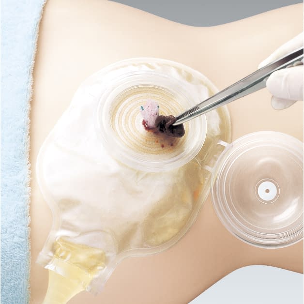 Surge Drain Open Top (M) M Drainage Bag 23-7440-02 Alcare 15682 (2-pack)