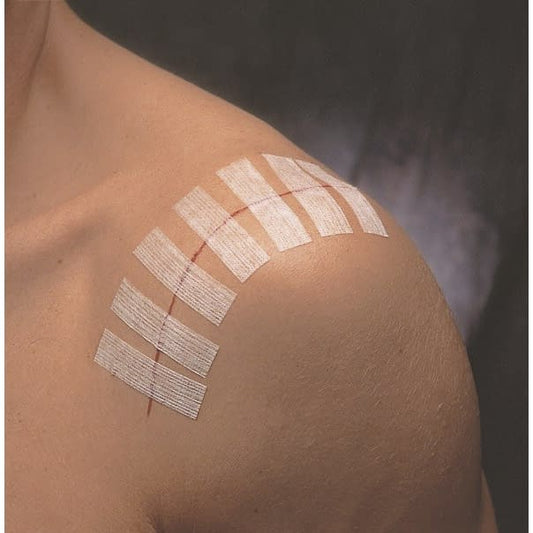 Steri-Strip Standard (SP) Skin Adhesive Tape 25-2838-00 3M Japan R1541SP (6X75) 3pcs 10pcs