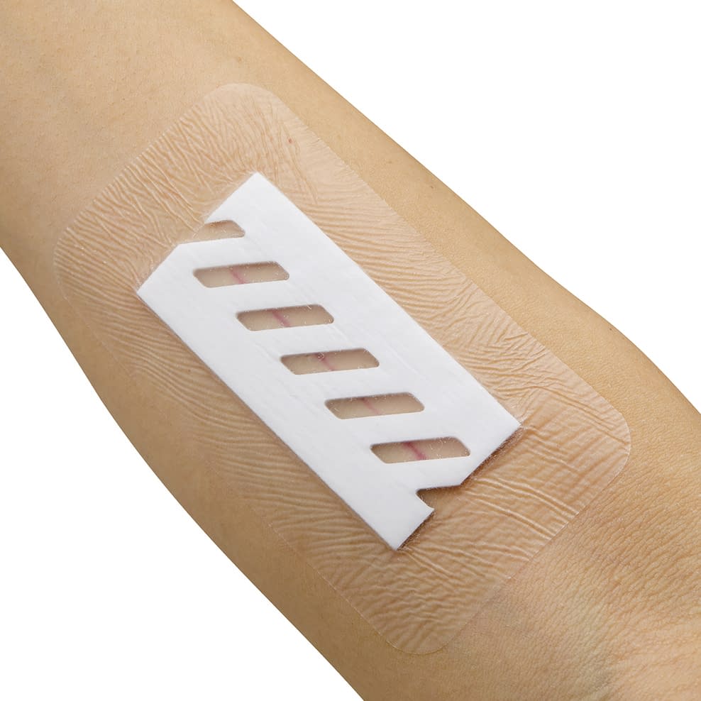 サージフィット ドレッシング材 24-7921-00 ニチバン SRG0610(30マイイリ)