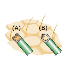 ティックツウィーザー・ウルトラ ダニ除去器 23-3879-00 飯塚カンパニー TU-011(ケイ15X109MM)