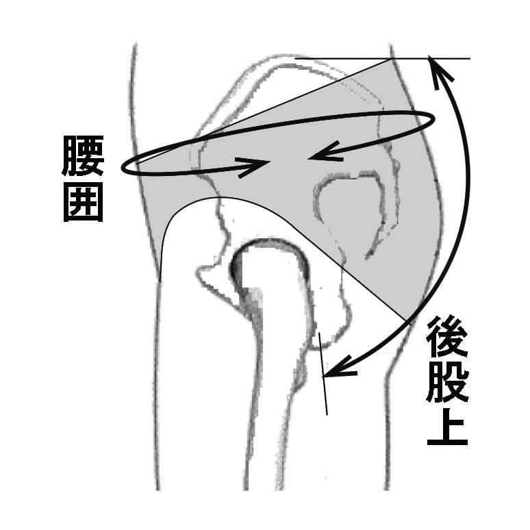 アダム骨盤底サポーター APS-90K コルセット 24-8407-01 アダム医健 APS-90K(H85-95CM)