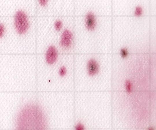 MC-Media Pad YM 진균(곰팡이·효모)용(100장) SK05B25 1상자(25장×4봉투입)