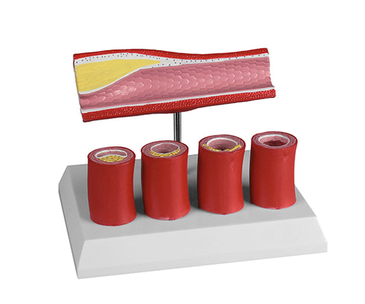 動脈硬化モデル　G240 1個