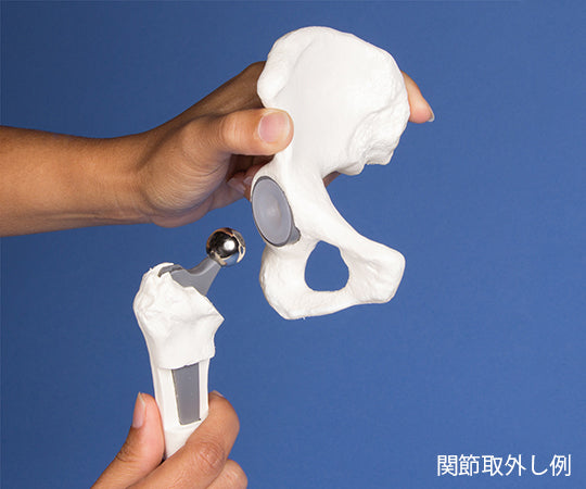股関節インプラント術説明モデル　1115 1式