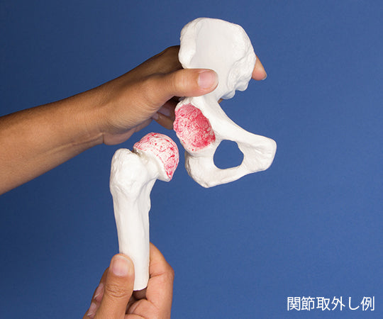股関節インプラント術説明モデル　1115 1式