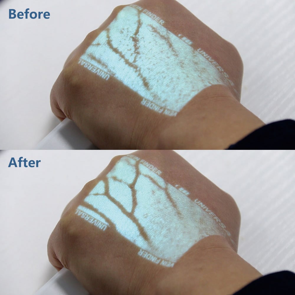 エンハンサー　NVE100 1個