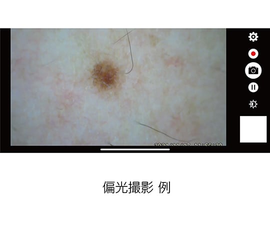 Digital dermatoscope DE370 1 unit