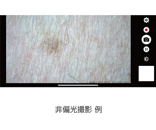 Digital dermatoscope DE370 1 unit