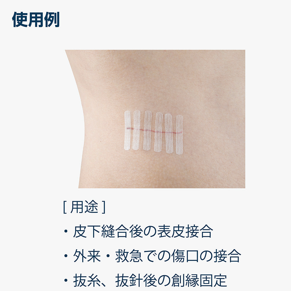 네비스트립(피부 접합용 테이프) 6×38mm 6개×10봉투입 SC638 1상자(6개×10봉투입)