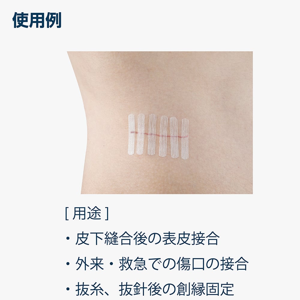 내비스트립(피부 접합용 테이프) 6×75mm 3개×10봉투입 SC675 1상자(3개×10봉투입)