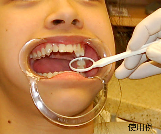 오랄 와이더 하드 1개입 1개