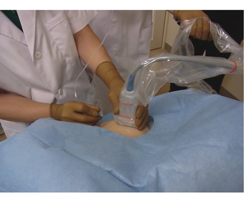 Echo probe cover II (for body openings and intraoperative use) 200mm 1 box (24 sets) P09020 1 box (24 sets)